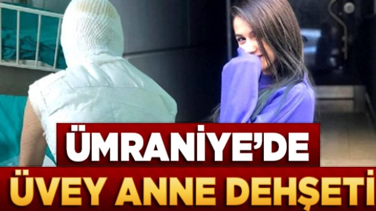 Ümraniye'de üvey anne dehşeti! Başından aşağı kaynar su döktü